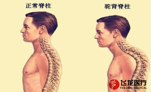 脊柱健康，不向生活&ldquo;低頭&rdquo;