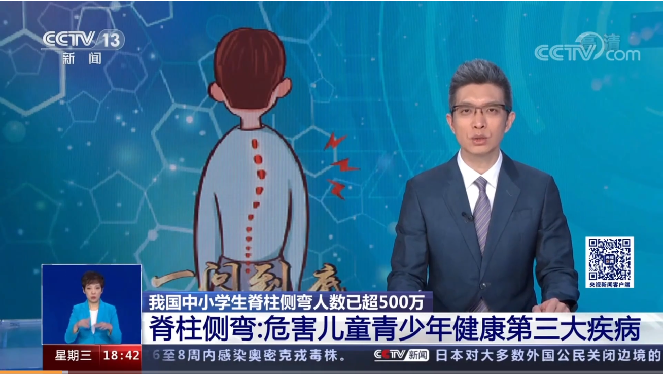 青少年脊柱側彎現(xiàn)狀堪憂 青少年脊柱側彎現(xiàn)狀堪憂